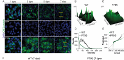 Subcellular distribution for WT and P79S ORF2 protein in electroporated HepG2 cells.