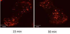 Photo  Visualisation of integrin endocytosis