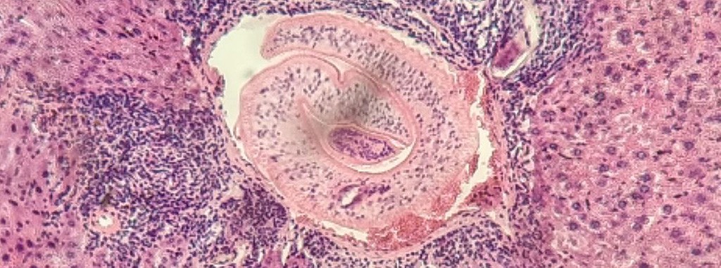 Close-up with a microscope