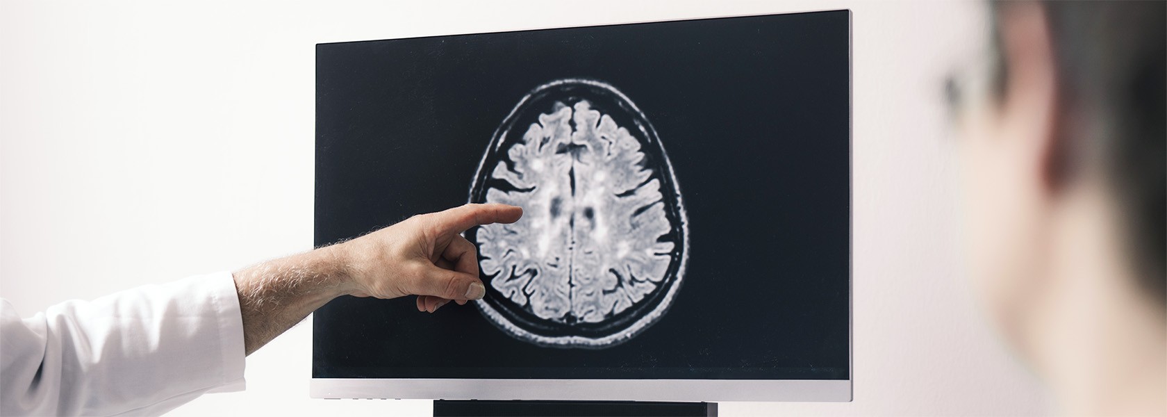 Arzt:in zeigt mit dem Finger auf ein Bildschirm, auf dem ein CT-Bild vom Gehirn zu sehen ist